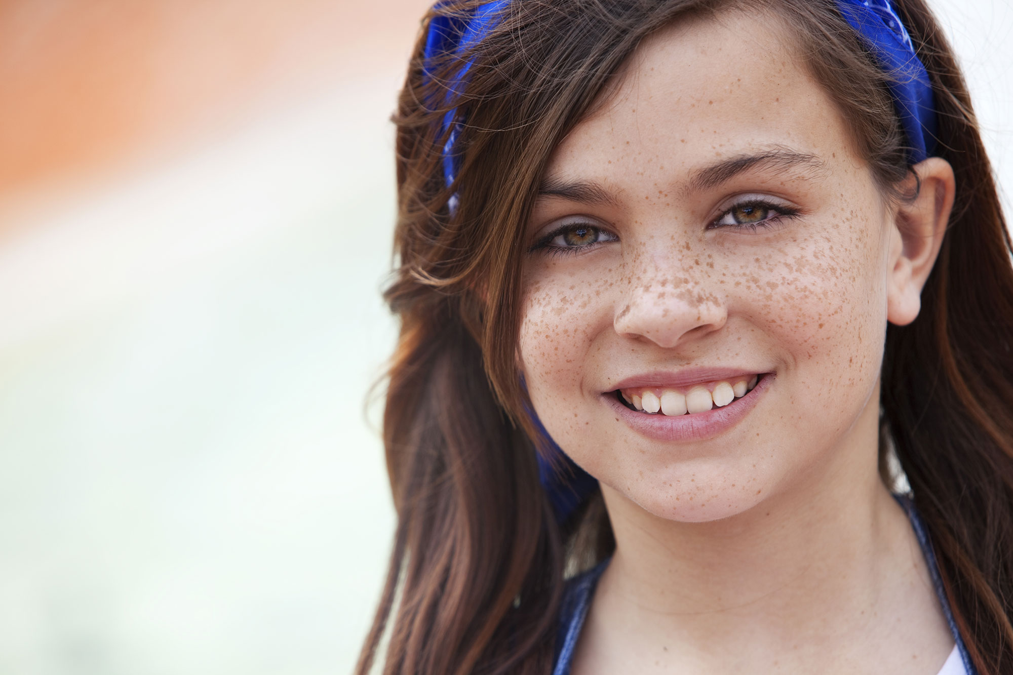 5-things-every-freckly-person-should-know
